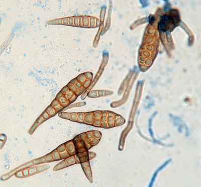 Alternaria spore