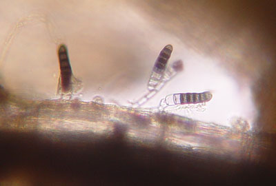 Conidia on root