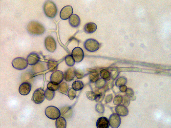 Downy mildew sporangia