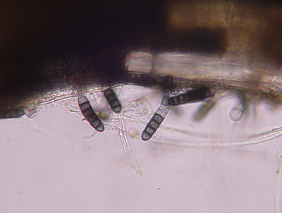 Thielaviopsis spores